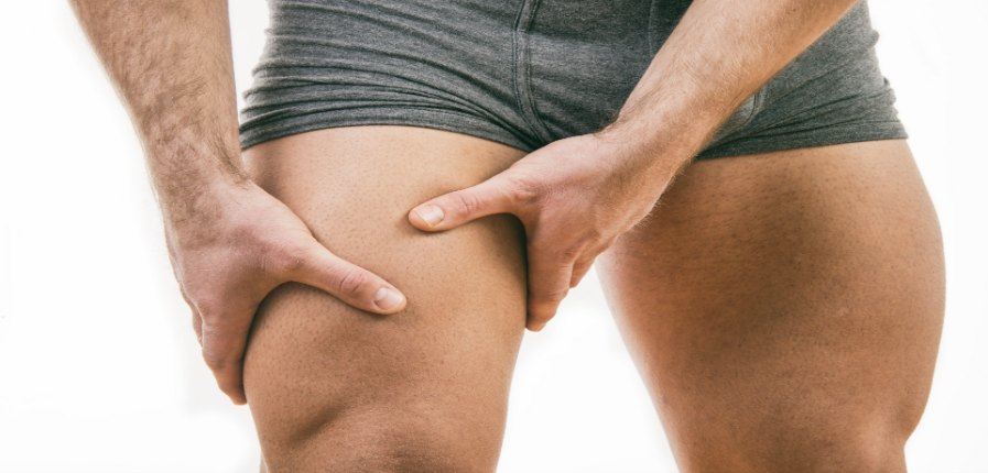 Quadriceps contusion or a “cork thigh”, as it is commonly known, is the result of a severe impact to the thigh which consequently compresses against the hard surface of the femur (thigh bone).